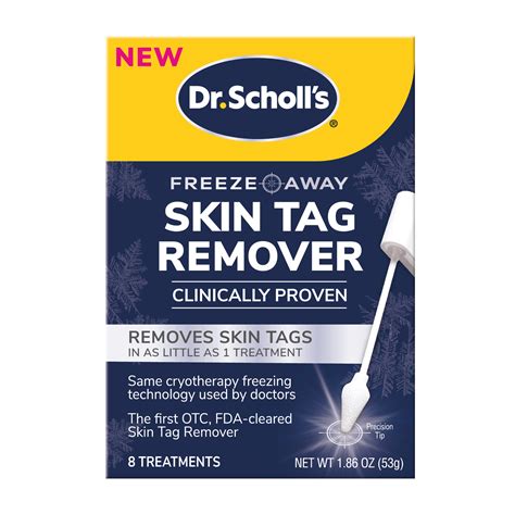 rf skin tag removal|ultrasound skin tags removal.